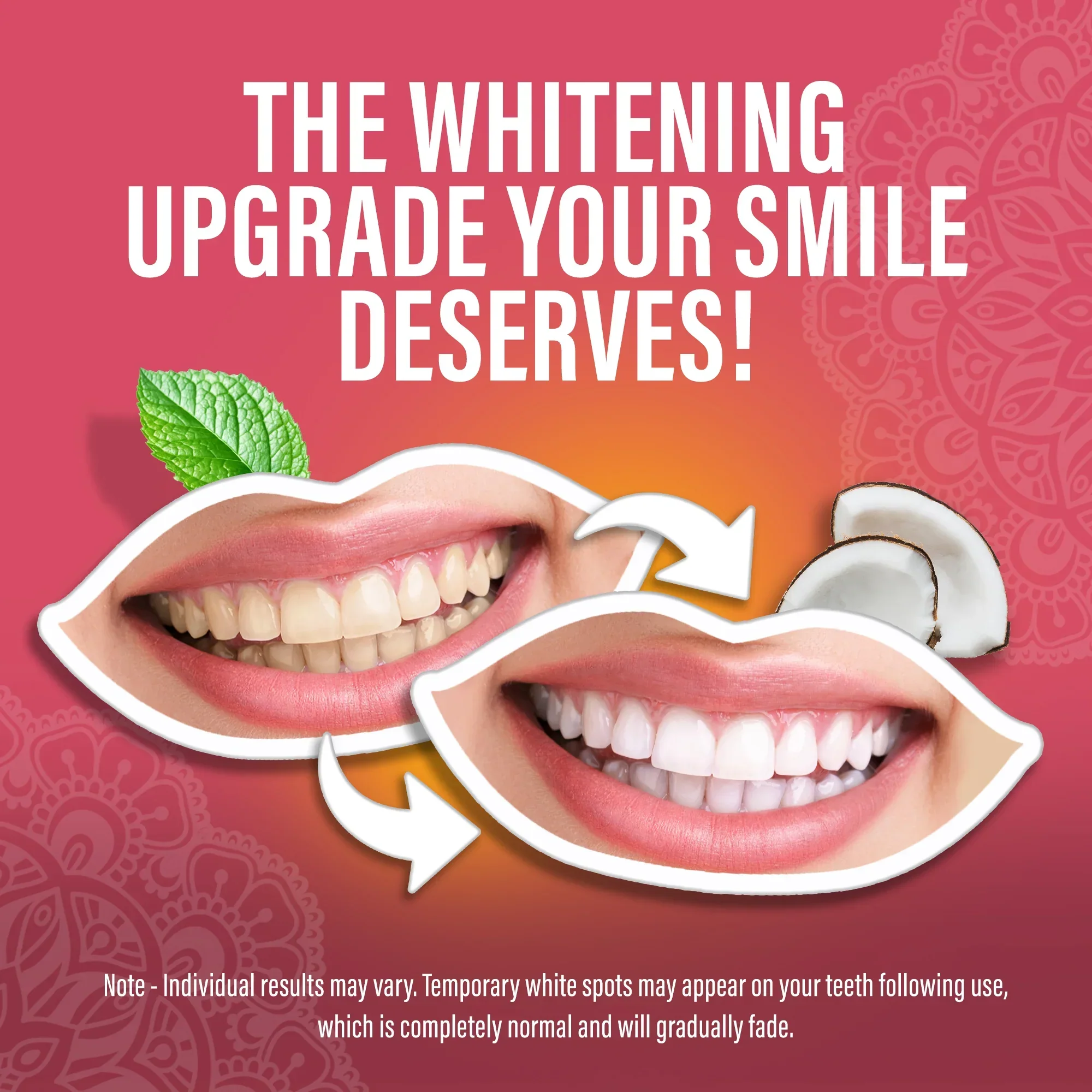 Sensitive Whitening Strips – 16 Day Treatment - Image 7
