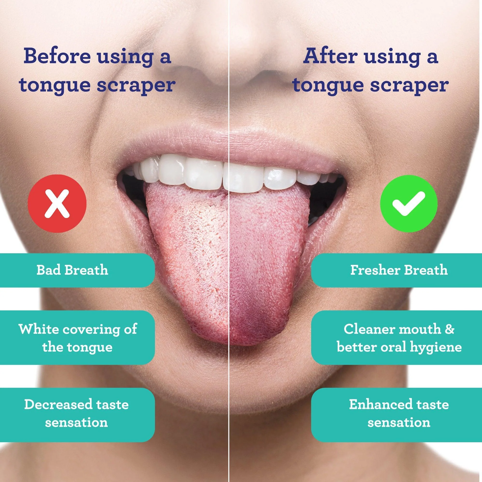 U Shaped Stainless Steel Tongue Scraper – 2 Pack - Image 3